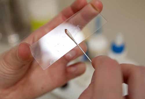 Škrábání vám umožní studovat střevní mikroflóru